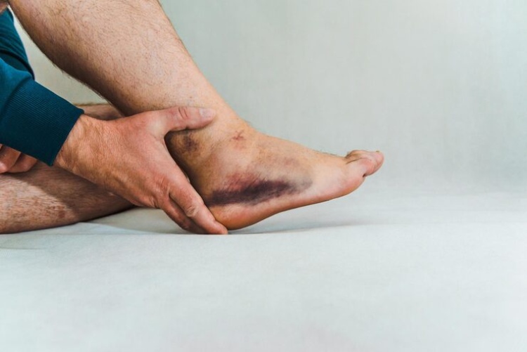 علت سیاه شدن پای دیابتی